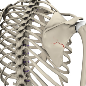 Shoulder Fracture