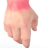 Wrist Pain